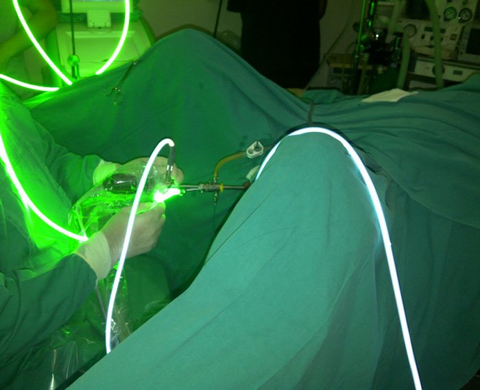 urologia-laser